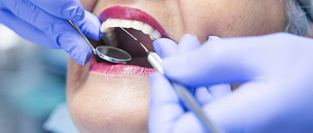 Best Emergency Wisdom Teeth Removal in Pecos, TX